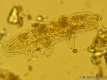 Tardigrades